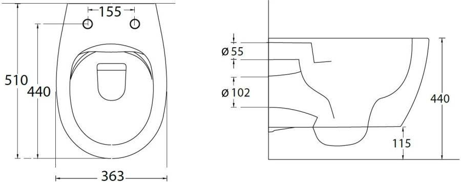 Подвесной унитаз Allen Brau Fantasy 4.11HC1.20 Подвесной унитаз Allen Brau Fantasy 4.11HC1.20