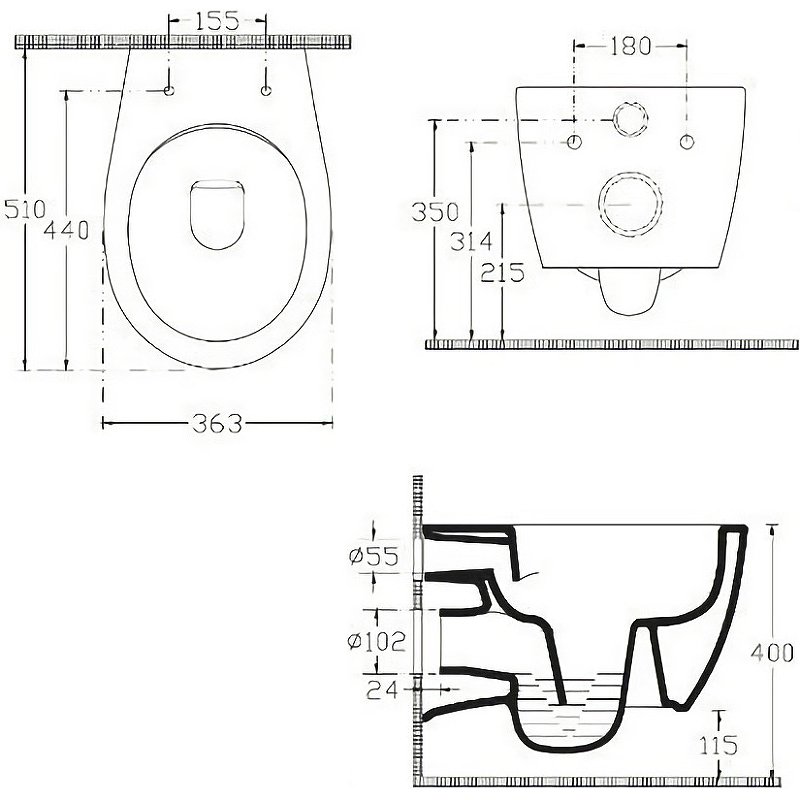 Подвесной унитаз Allen Brau Fantasy 4.11HC1.20 Подвесной унитаз Allen Brau Fantasy 4.11HC1.20