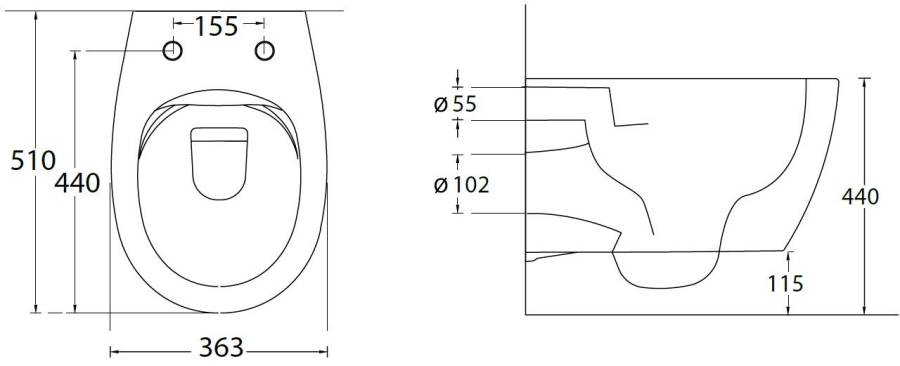 Чаша подвесного унитаза Allen Brau Fantasy 4.11004.SM розовый Чаша подвесного унитаза Allen Brau Fantasy 4.11004.SM розовый