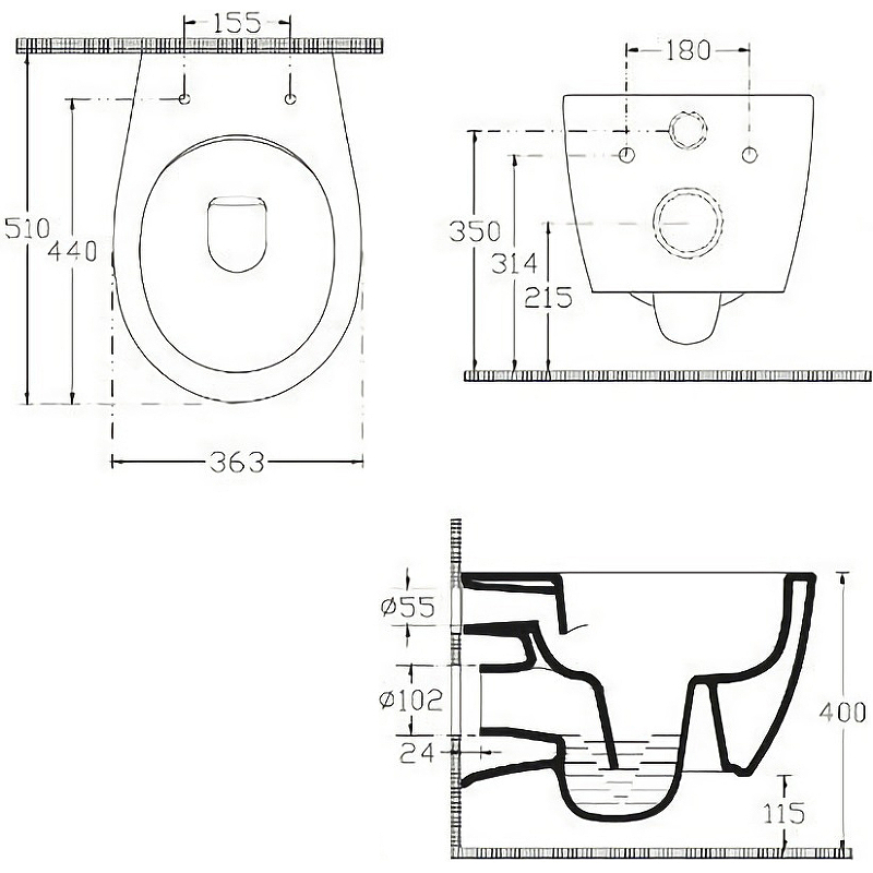 Подвесной унитаз Allen Brau Fantasy 4.11HC1.20 Подвесной унитаз Allen Brau Fantasy 4.11HC1.20