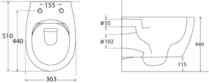Подвесной унитаз Allen Brau Fantasy 4.11004.IV айвори Подвесной унитаз Allen Brau Fantasy 4.11004.IV айвори