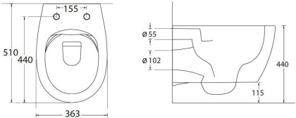 Подвесной унитаз Allen Brau Fantasy 4.11004.20 Подвесной унитаз Allen Brau Fantasy 4.11004.20