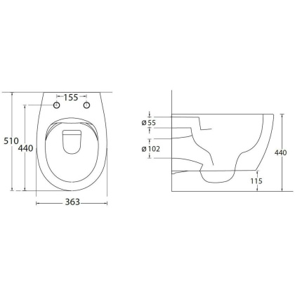 Подвесной унитаз Allen Brau Fantasy 4.11004.20 Подвесной унитаз Allen Brau Fantasy 4.11004.20